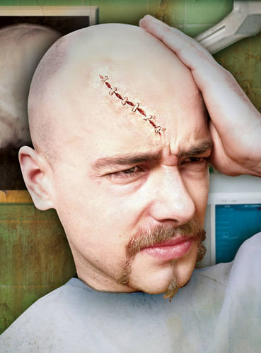 Jazva zošívaná Jazva zošívaná